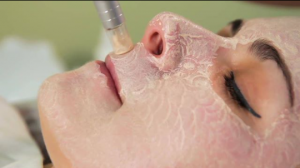 Skin needling benefits: dr pen microneedling | dr pen derma pen (dr pen UK)